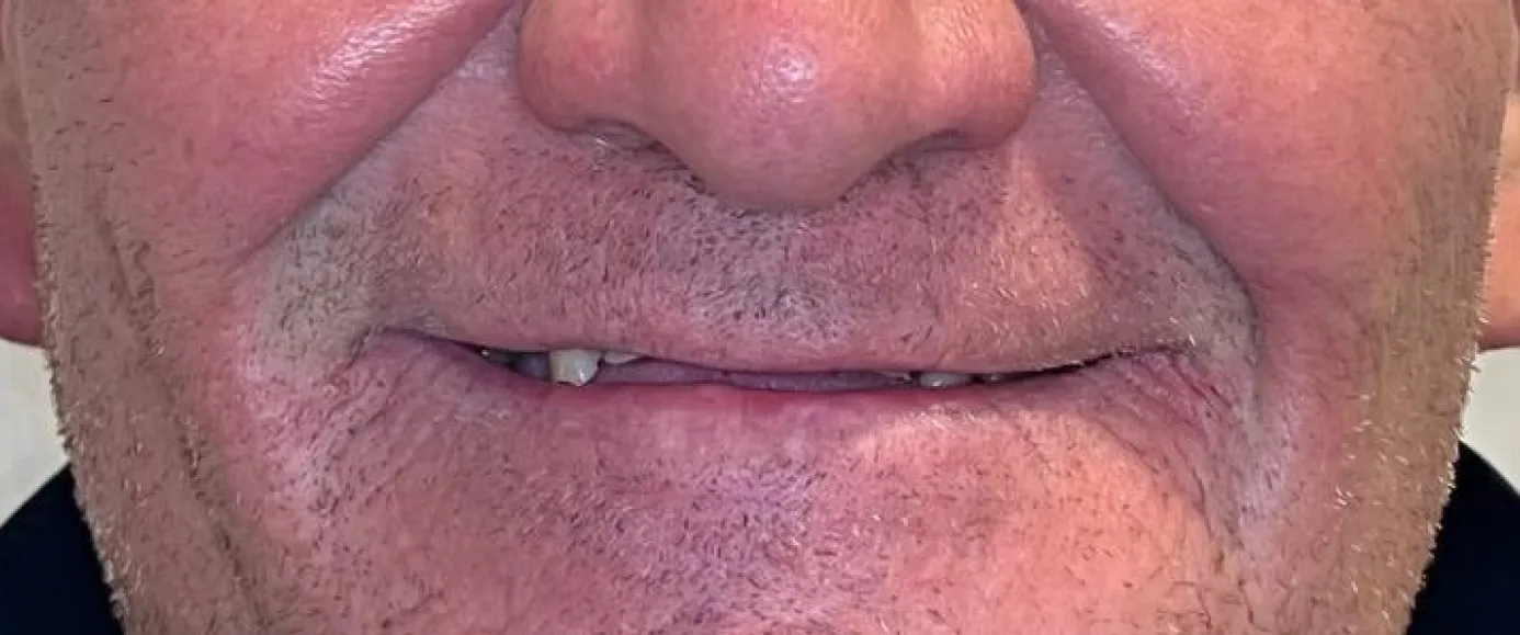 Before treatment, example 1