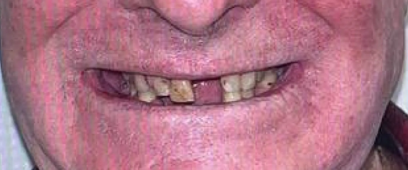 Before treatment, example 2